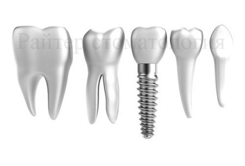 имплантанты для зубов